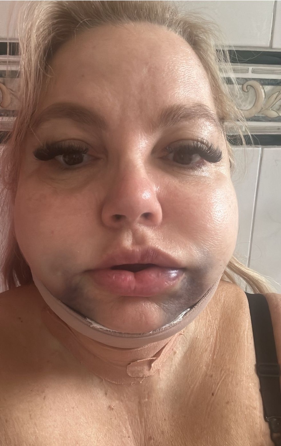 Imagem enviada por Eloah para a cirurgiã dentista logo após o procedimento — Foto: Reprodução/Arquivo Pessoal