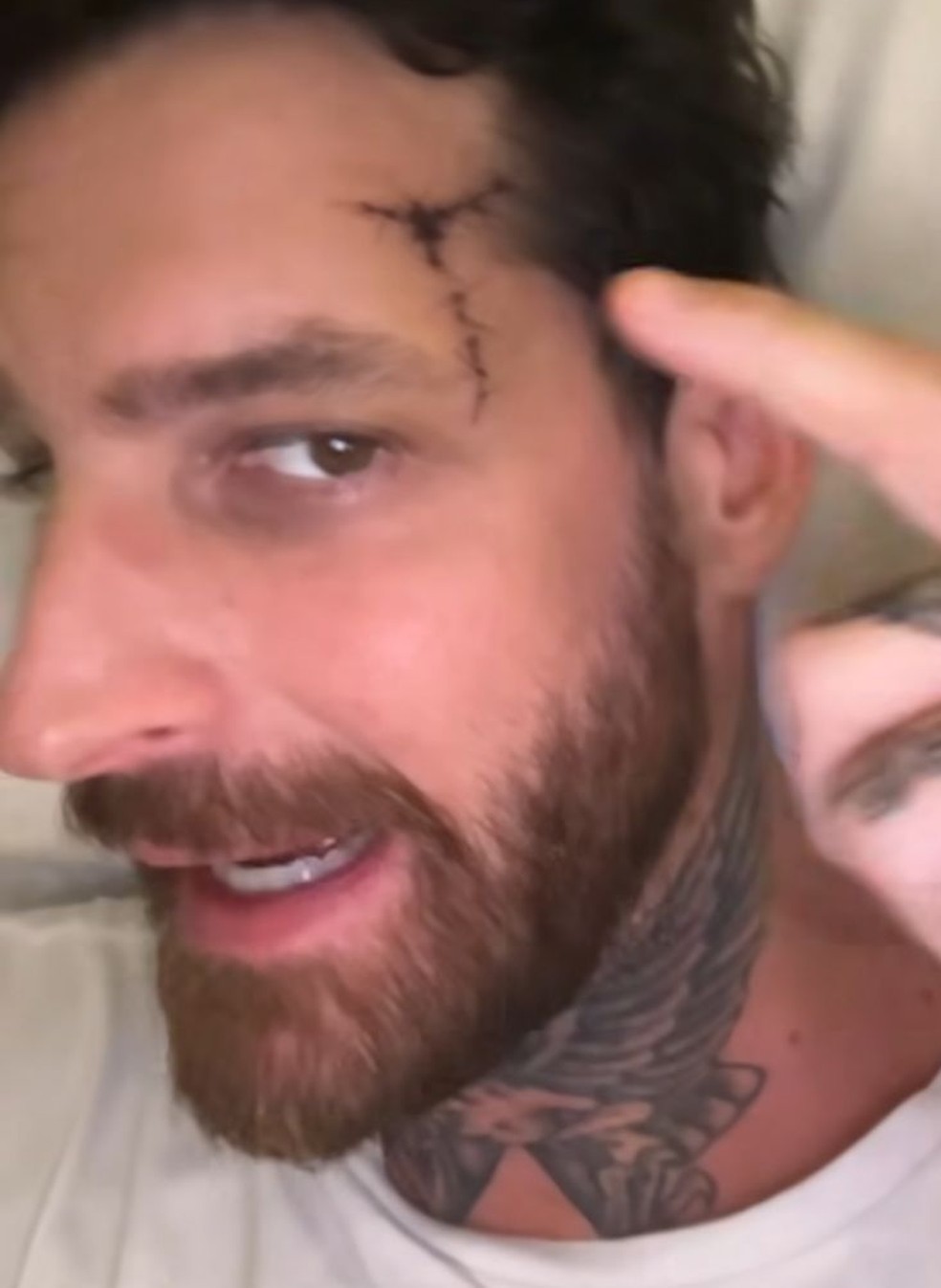 Leandro D&rsquo;Lucca, marido de Cleo Pires, fala sobre estado de sa&uacute;de ap&oacute;s bater a cabe&ccedil;a &mdash; Foto: Reprodu&ccedil;&atilde;o Instagram