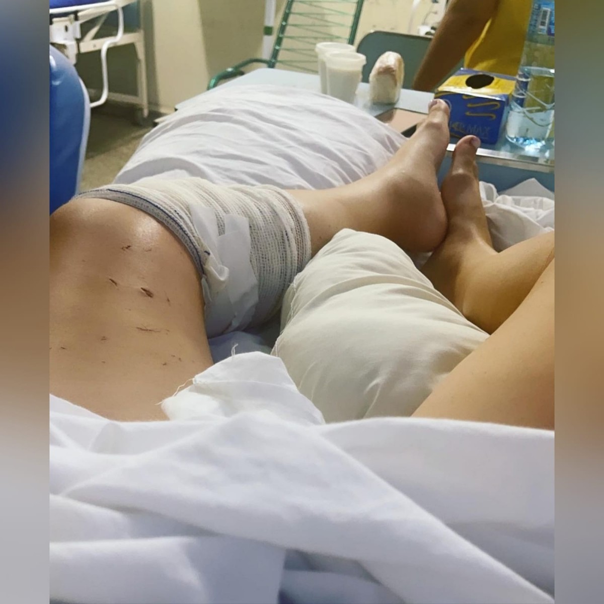 Caminhoneira conhecida como Musa das Estradas posta foto em hospital após  acidente com carreta: Quero tanto ir para casa | Mato Grosso | G1