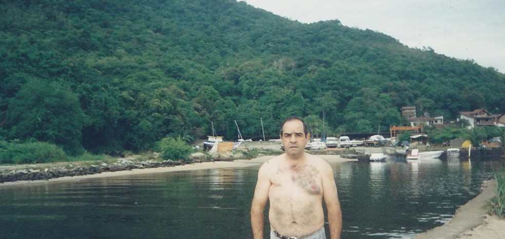 Foto de José Simões após ter feito a cirurgia de retirada do tumor. Ele ficou sem a mama direita. — Foto: Arquivo pessoal/José Simões