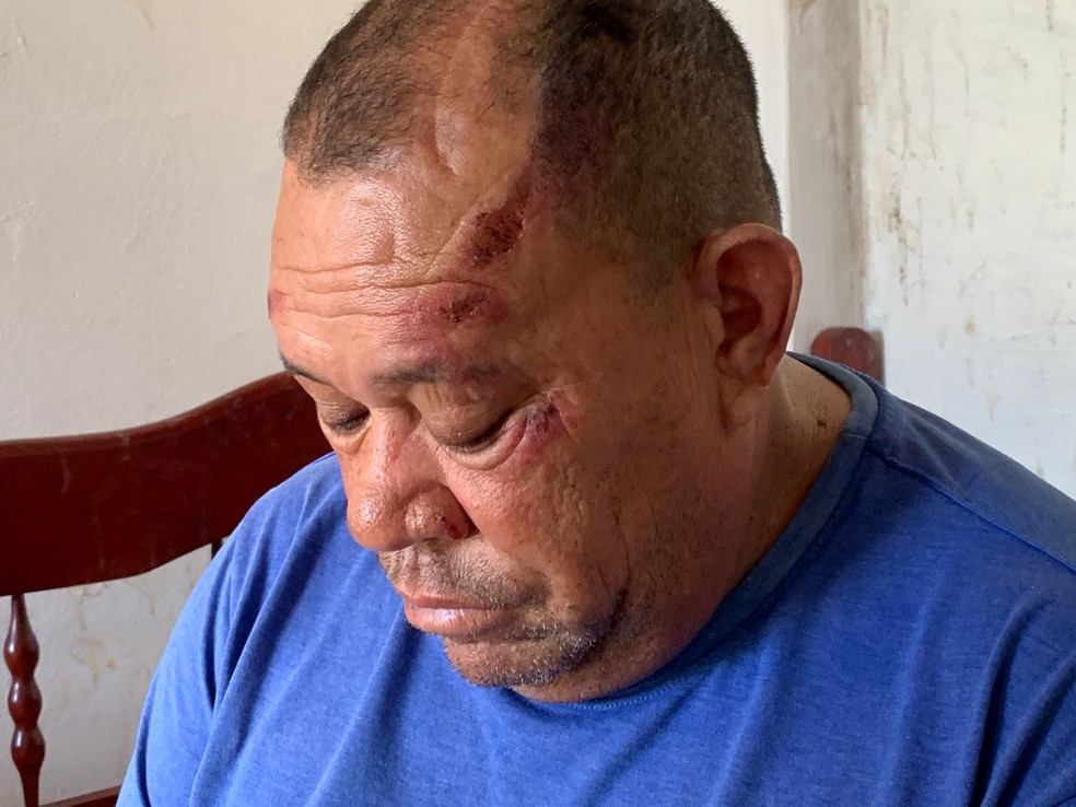 Autônomo Erasmo Carlos foi uma das pessoas atropeladas por motorista na Zona Norte de Natal — Foto: Gustavo Brendo/Inter TV Cabugi