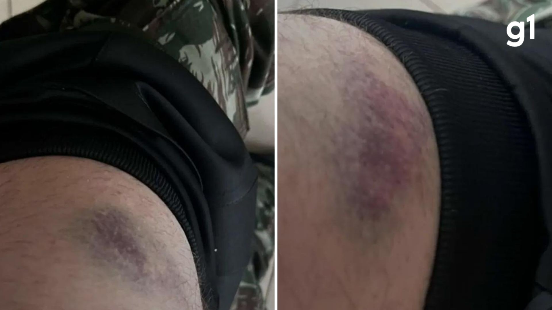 Soldado de 19 anos relata agressão por colegas dentro de quartel no RS