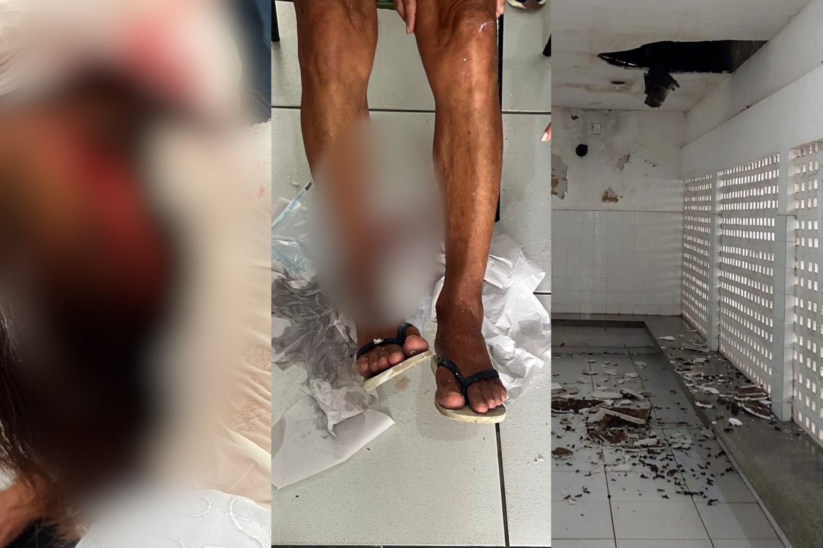 Três pacientes ficam feridos após parte de forro de UBS cair em Teresina; Coren fiscalizava local