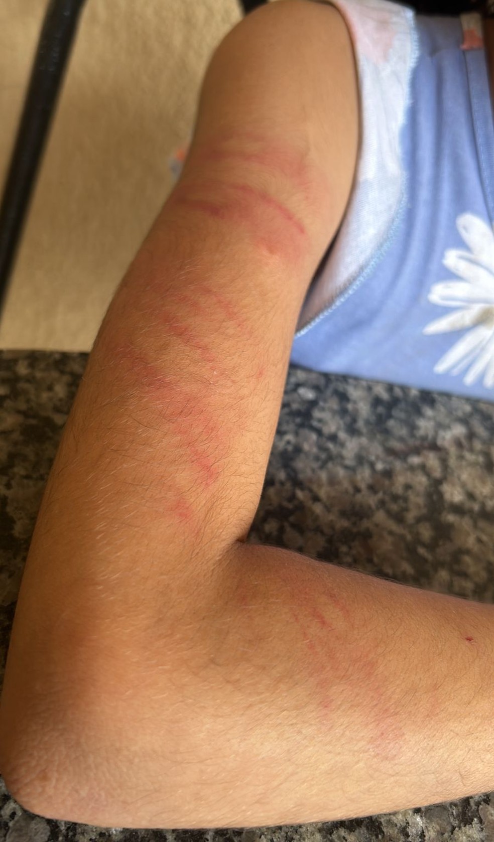Crianças foram encontradas com vários hematomas pelo corpo — Foto: Arquivo pessoal