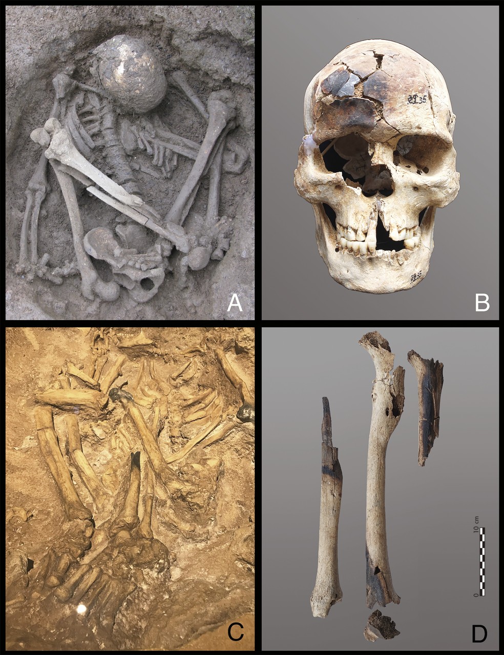 Exemplos de sepultamentos hiperflexionados com ossos parcialmente queimados do sul da China e da Indonésia. — Foto: Divulgação/PNAS