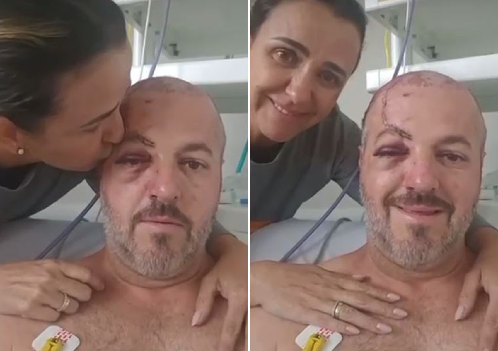 Acidente em torneio de beach tennis: vÃtima agradece orações após sobreviver; vÃdeo