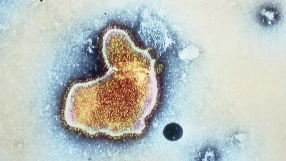 Vírus Sincicial Respiratório, em imagem microscópica  — Foto: GETTY IMAGES via BBC