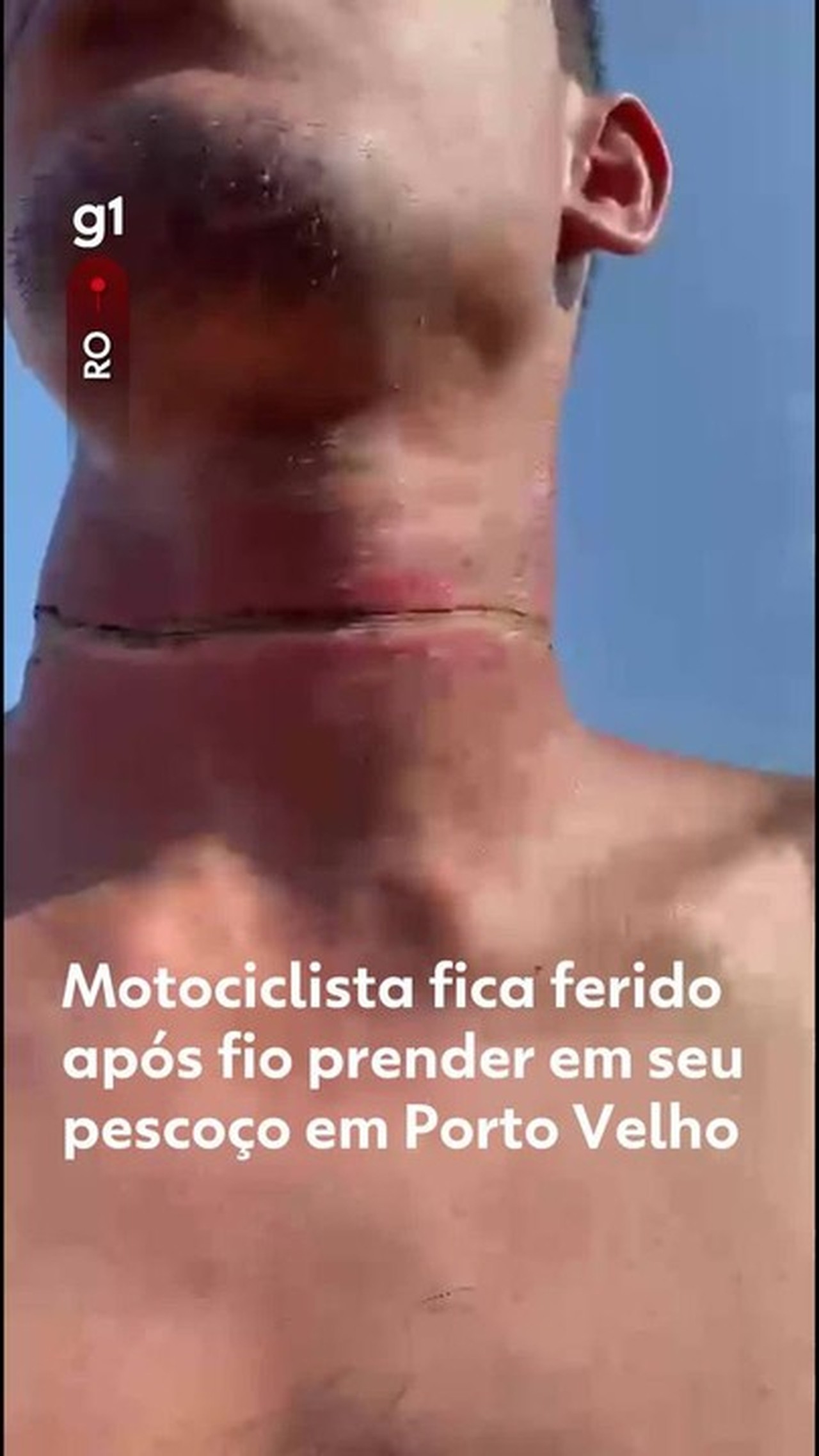 Homem fica ferido após fiação enroscar em seu pescoço enquanto andava de moto em Porto Velho
