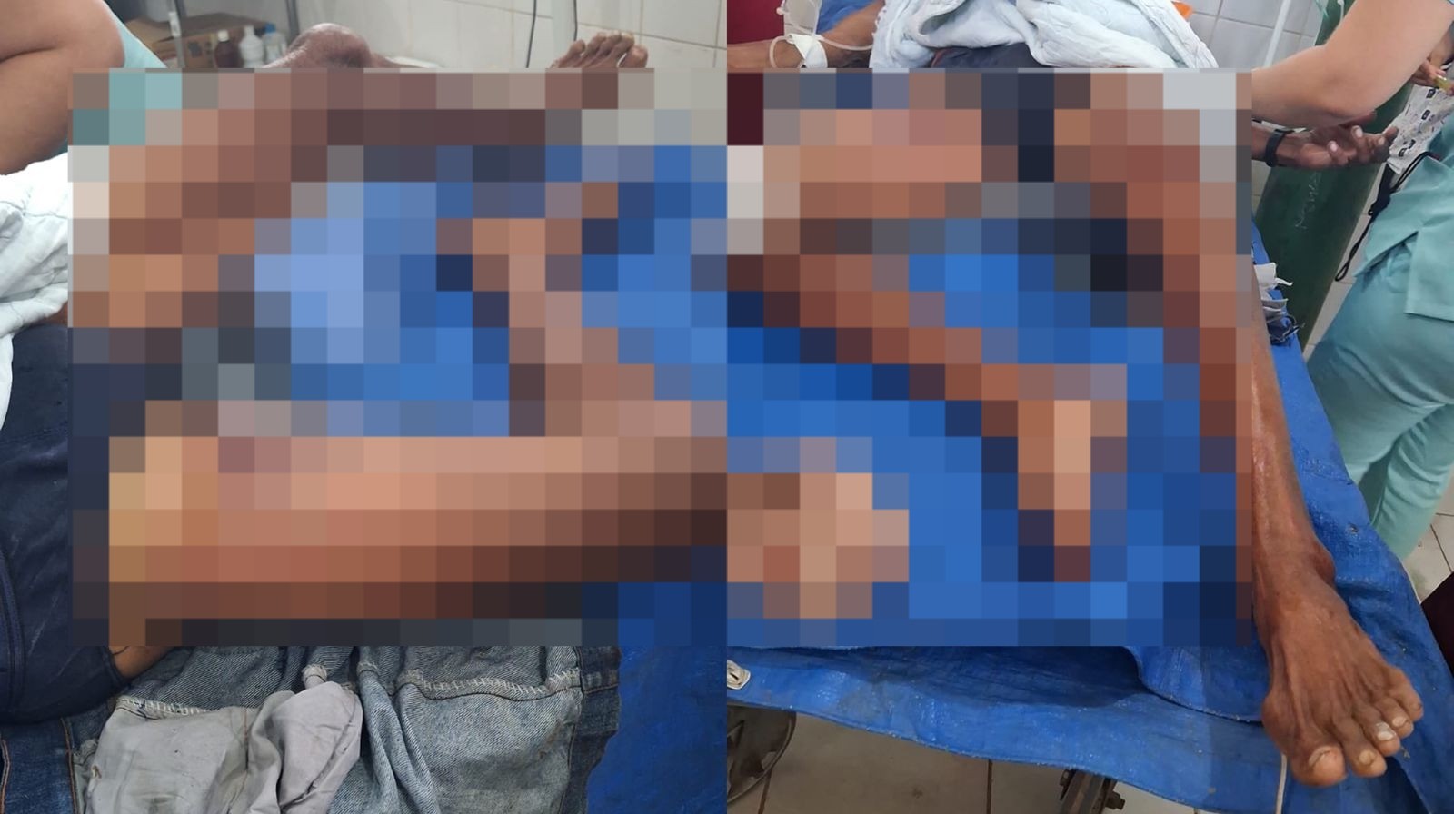 Idoso é encontrado amarrado em cerca após assalto em comunidade de várzea de Óbidos, no Pará