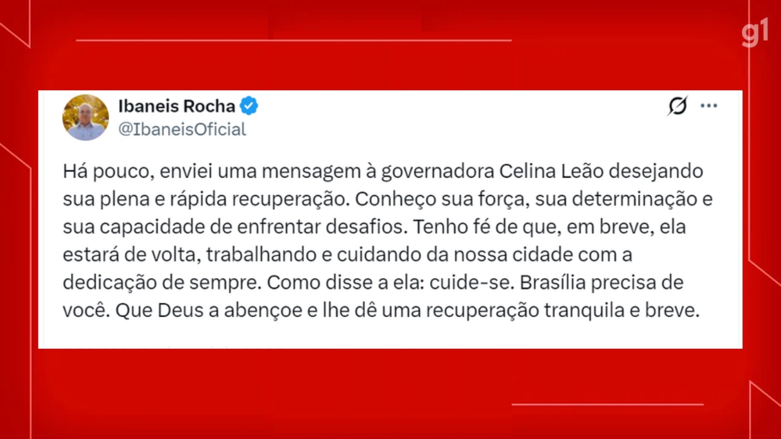 Após romper com Celina Leão, Ibaneis Rocha deseja recuperação rápida à governadora: 'Brasília precisa de você'
