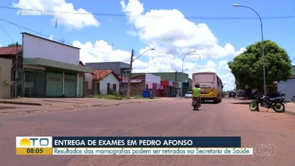 Resultados de mamografias podem ser retirados na Secretaria de Saúde em Pedro Afonso