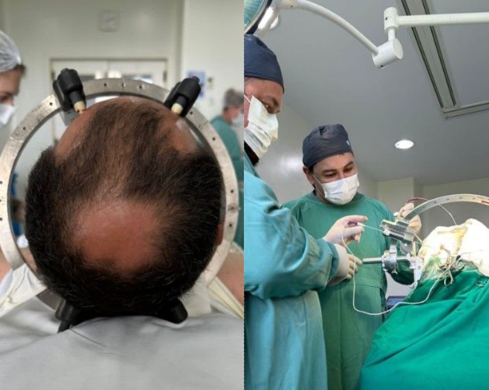 cirurgia para tratamento do TOC foi realizada em hospital de Florianópolis — Foto: Wuilker Knoner Campos/ Arquivo pessoal