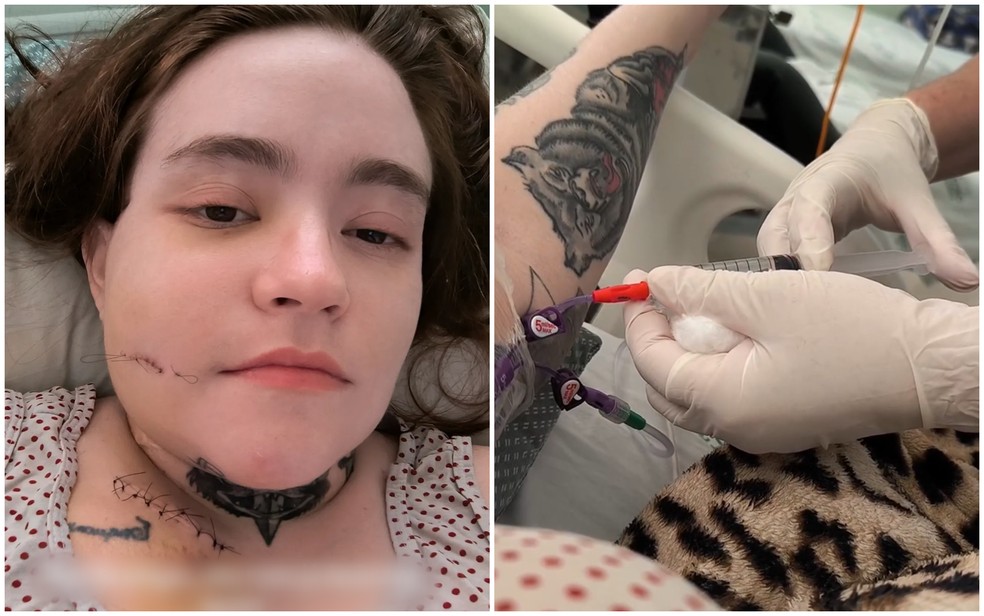 Carolina Arruda tem neuralgia do trigêmeo e mostra nas redes sociais a rotina do tratamento na Santa Casa de Alfenas — Foto: Reprodução / Instagram