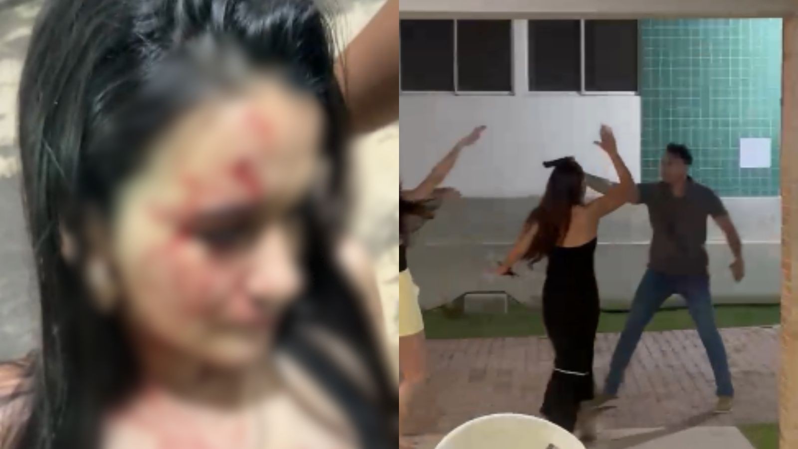 Jovem de 18 anos denuncia agressão com arma durante briga em condomínio no PI
