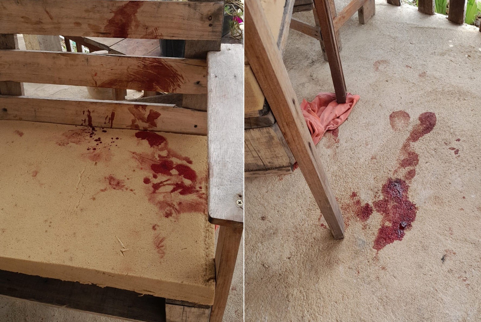 Bebê de 10 meses é atacado por pitbull e segue internado em estado grave em Campos