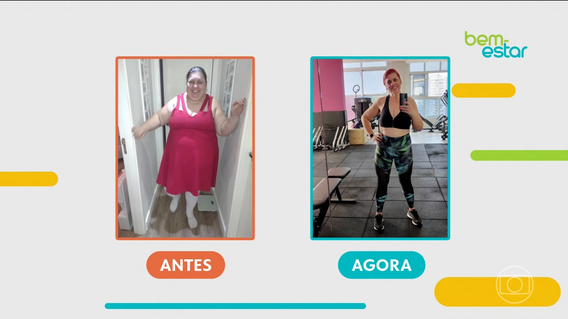 Sono e obesidade: mulher perde 100 quilos após bariátrica e mudança no estilo de vida; 'hoje durmo sem roncos e apneias'