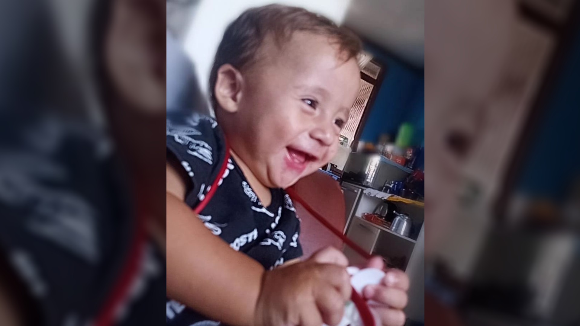 Menino de um ano é atacado por cachorro que foi doado para família há 15 dias no Paraná