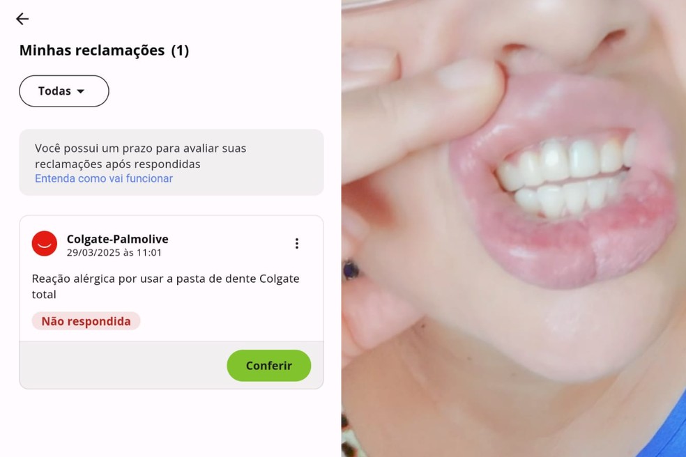 Educadora social, de 45 anos, sofreu reação alérgica após uso de pasta de dente, em Miracatu (SP) — Foto: Arquivo Pessoal