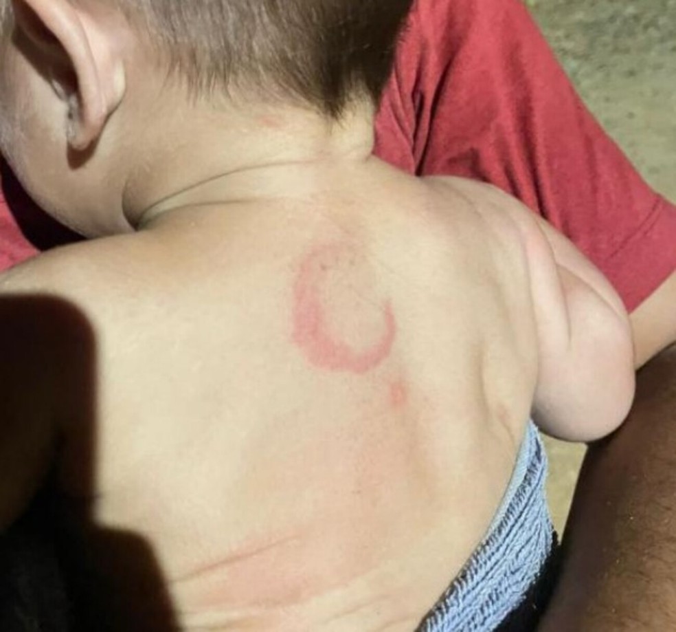 O bebê de 4 meses, está internado na Santa Casa de Campo Grande. — Foto: Reprodução