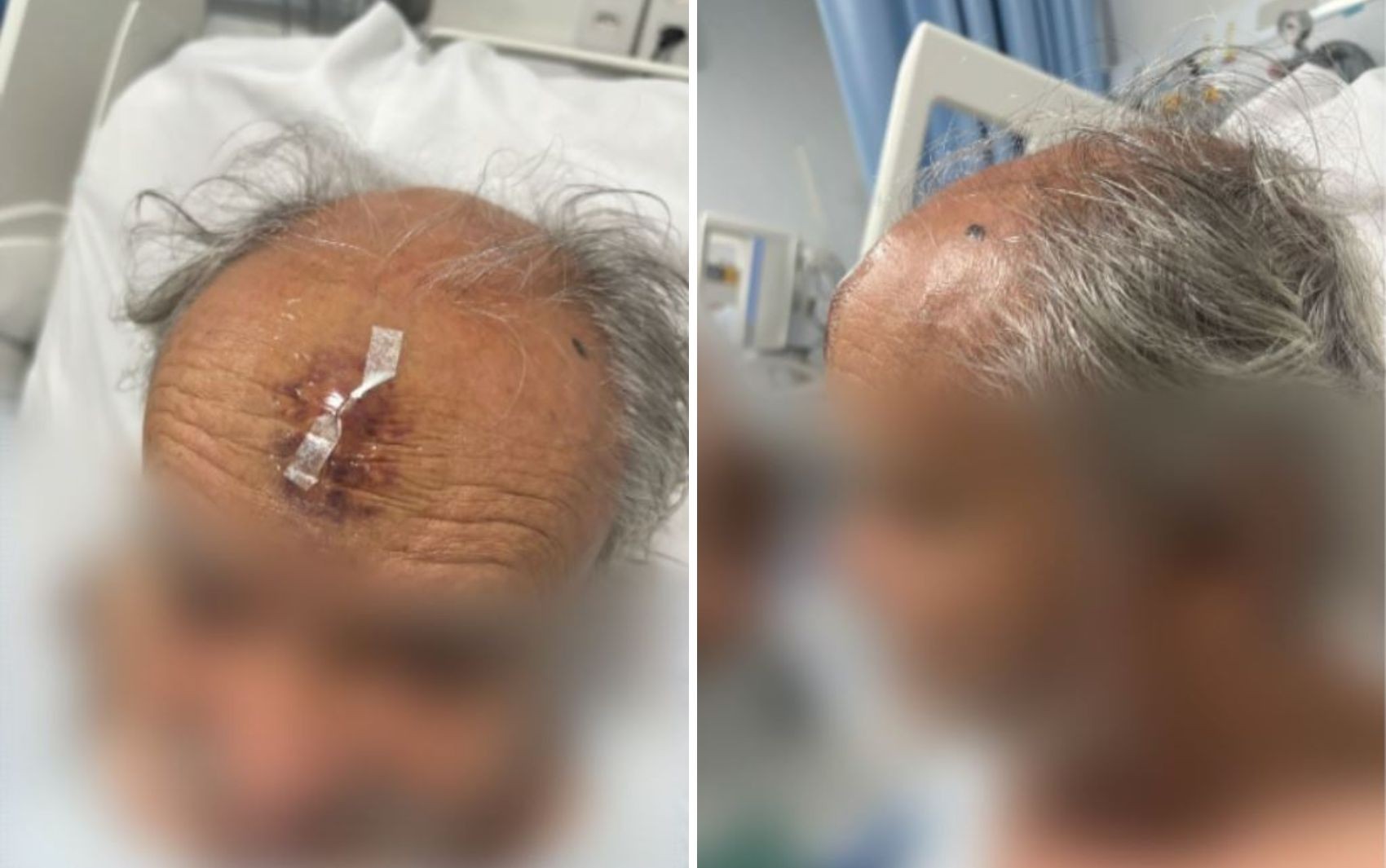 Idoso com suspeita de infarto é atingido na cabeça por aparelho médico dentro de ambulância em Franca, SP