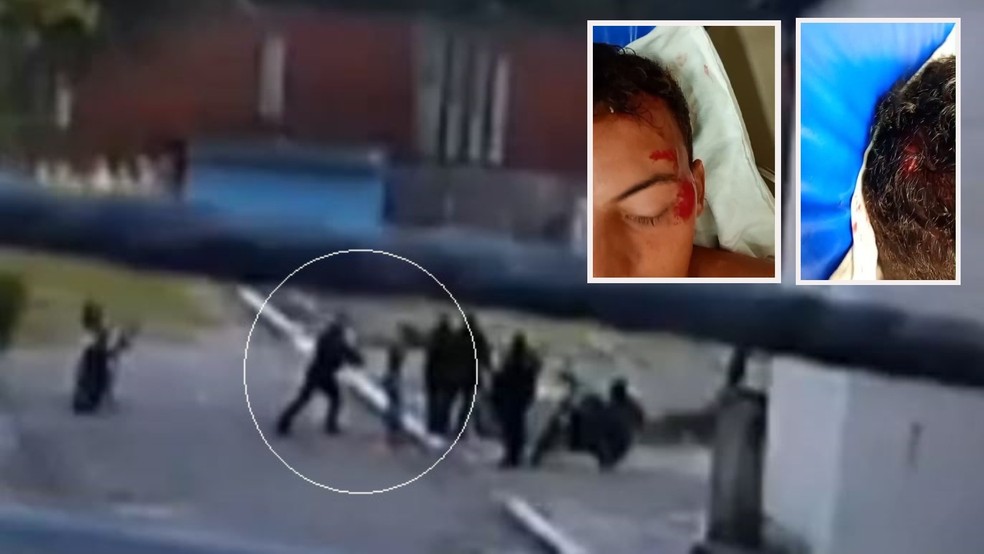 Jovem agredido por policial durante abordagem em Aquiraz possui uma deficiência intelectual de grau leve, atestada por um neurologista — Foto: Reprodução