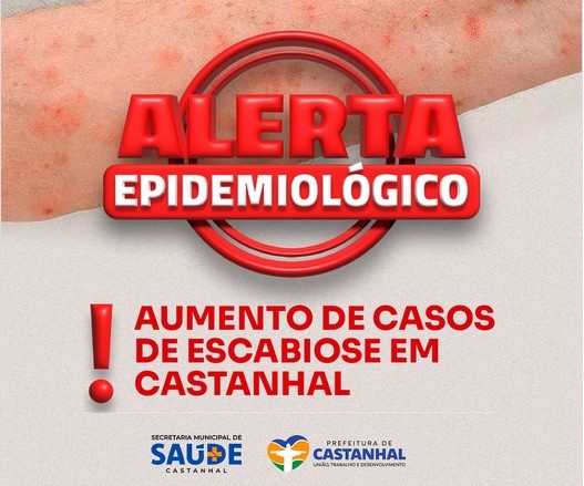 Castanhal emite alerta para aumento de casos de sarna; veja como se proteger