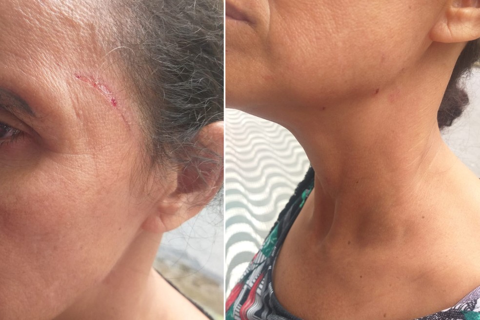 Mulher foi agredida por funcionária de posto de saúde em São Vicente (SP) ao questionar sobre consulta  pra neta com neurologista — Foto: Arquivo Pessoal