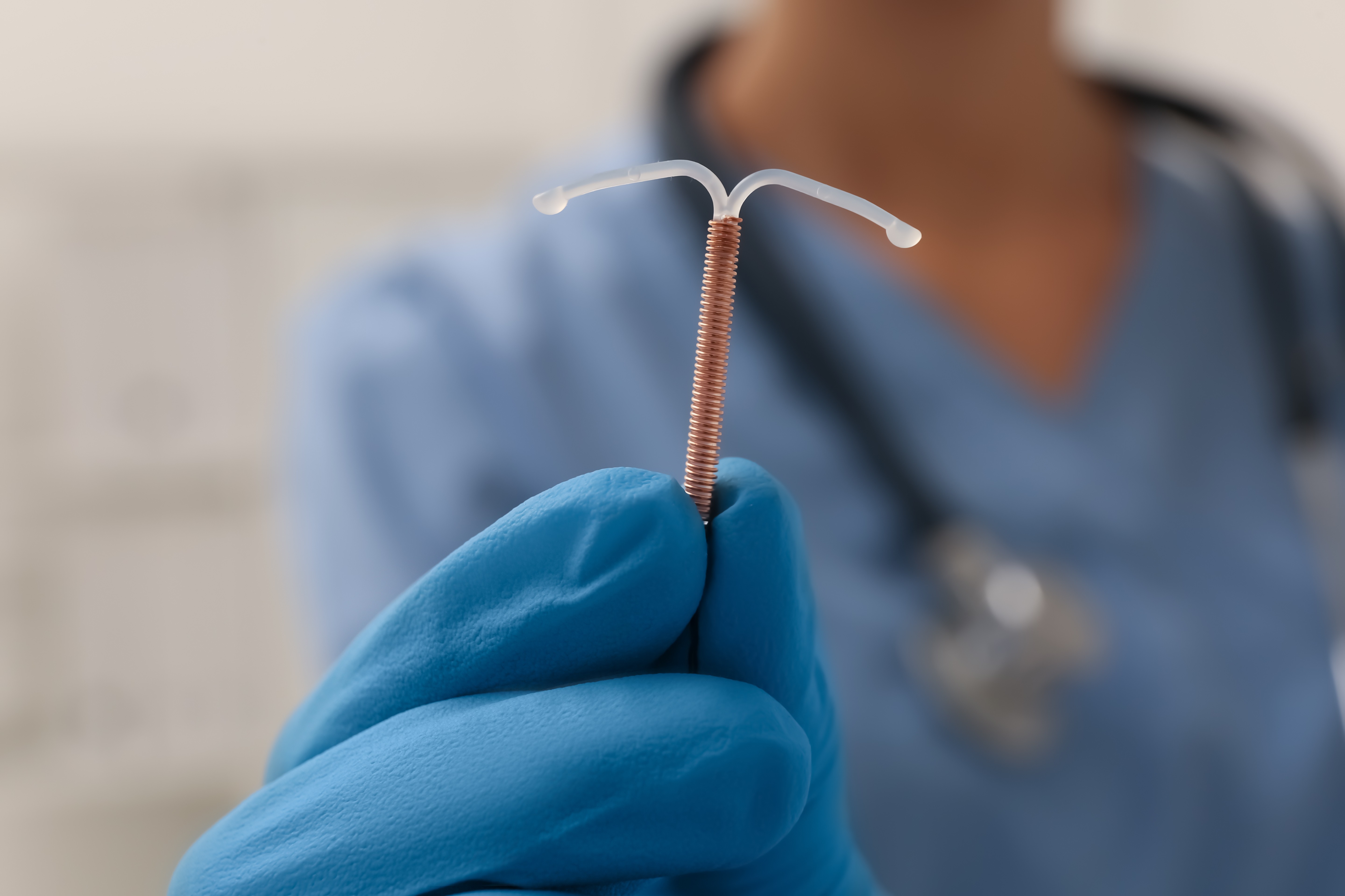 DIU hormonal Mirena tem prazo estendido de 5 para 8 anos para anticoncepção 