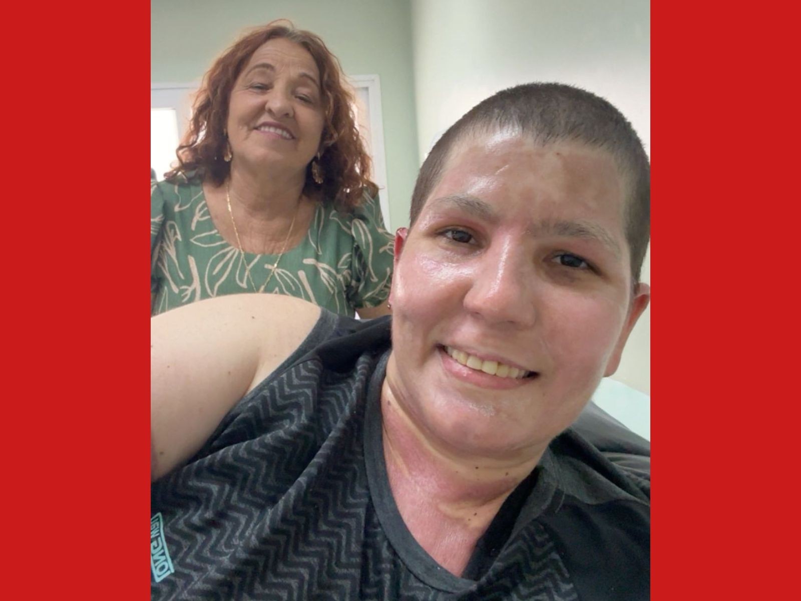 Mulher que teve 40% do corpo queimado recebe alta após 30 dias no Acre: 'Uma felicidade'