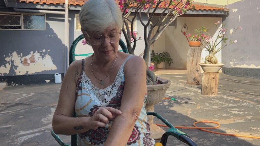 Feridas em Simeia apareceram nos braços, na coxa e na barriga em Estrela D'Oeste (SP) — Foto: Eduardo Monteiro/TV TEM