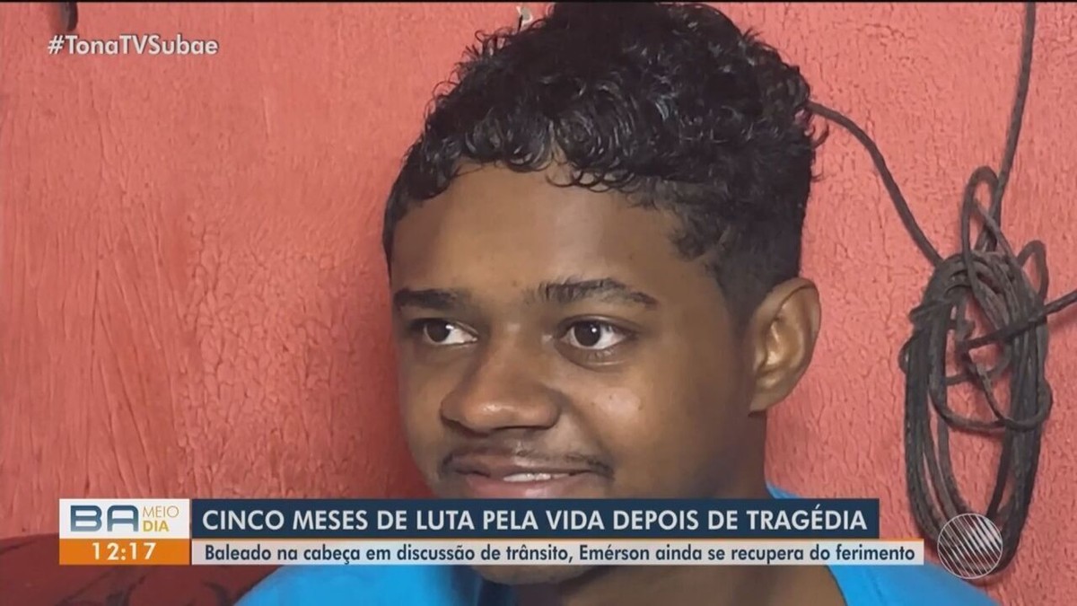 Cinco Meses Após Ser Atingido Por Tiro Na Cabeça Durante Briga No Trânsito Jovem Se Recupera No 0352