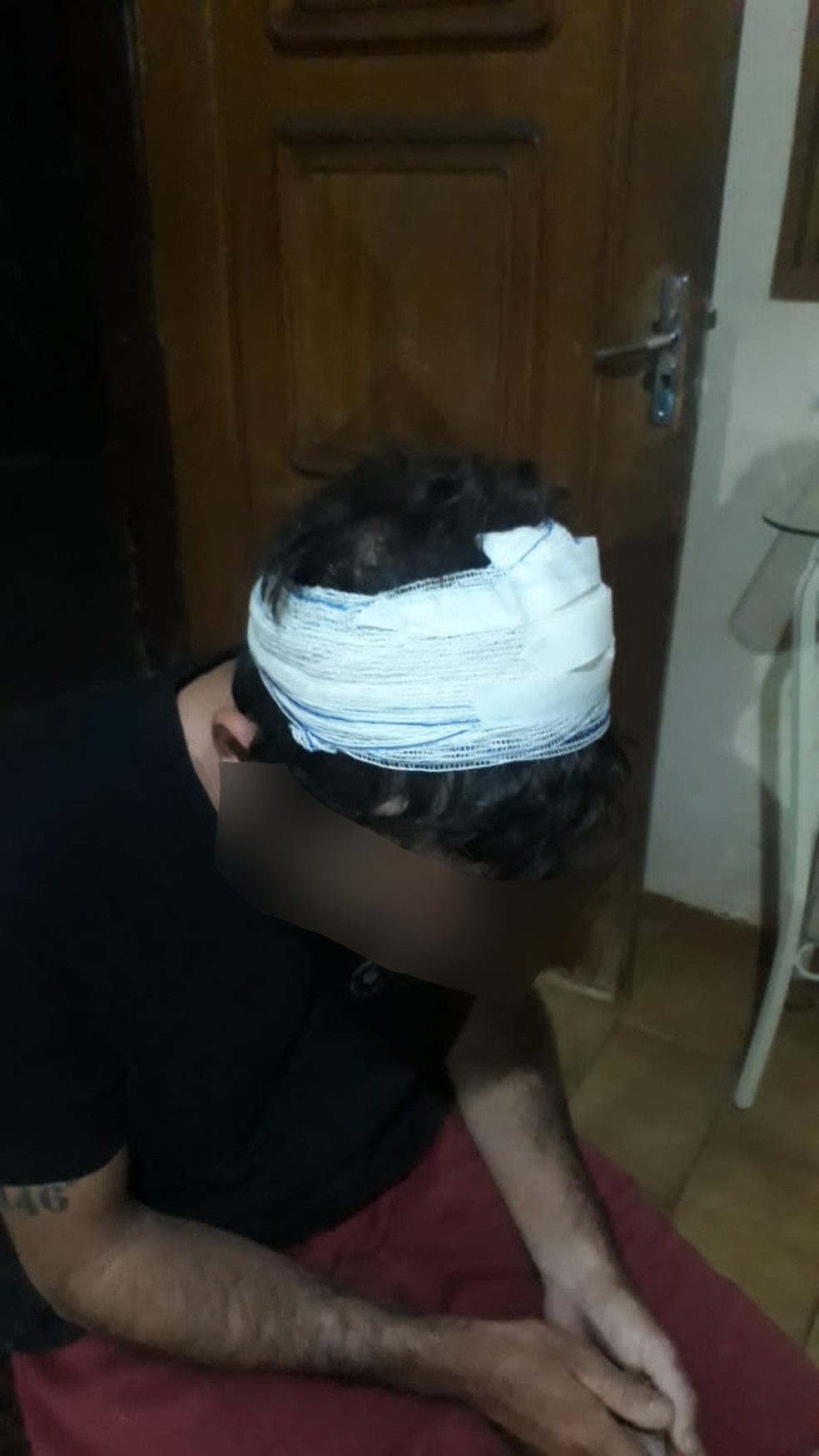 Vítima precisou levar pontos e não consegue trabalhar como motoboy  — Foto: arquivo pessoal