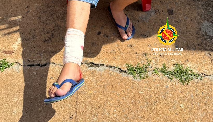 Pitbull ataca homem e mata cachorro no Paranoá, no DF 