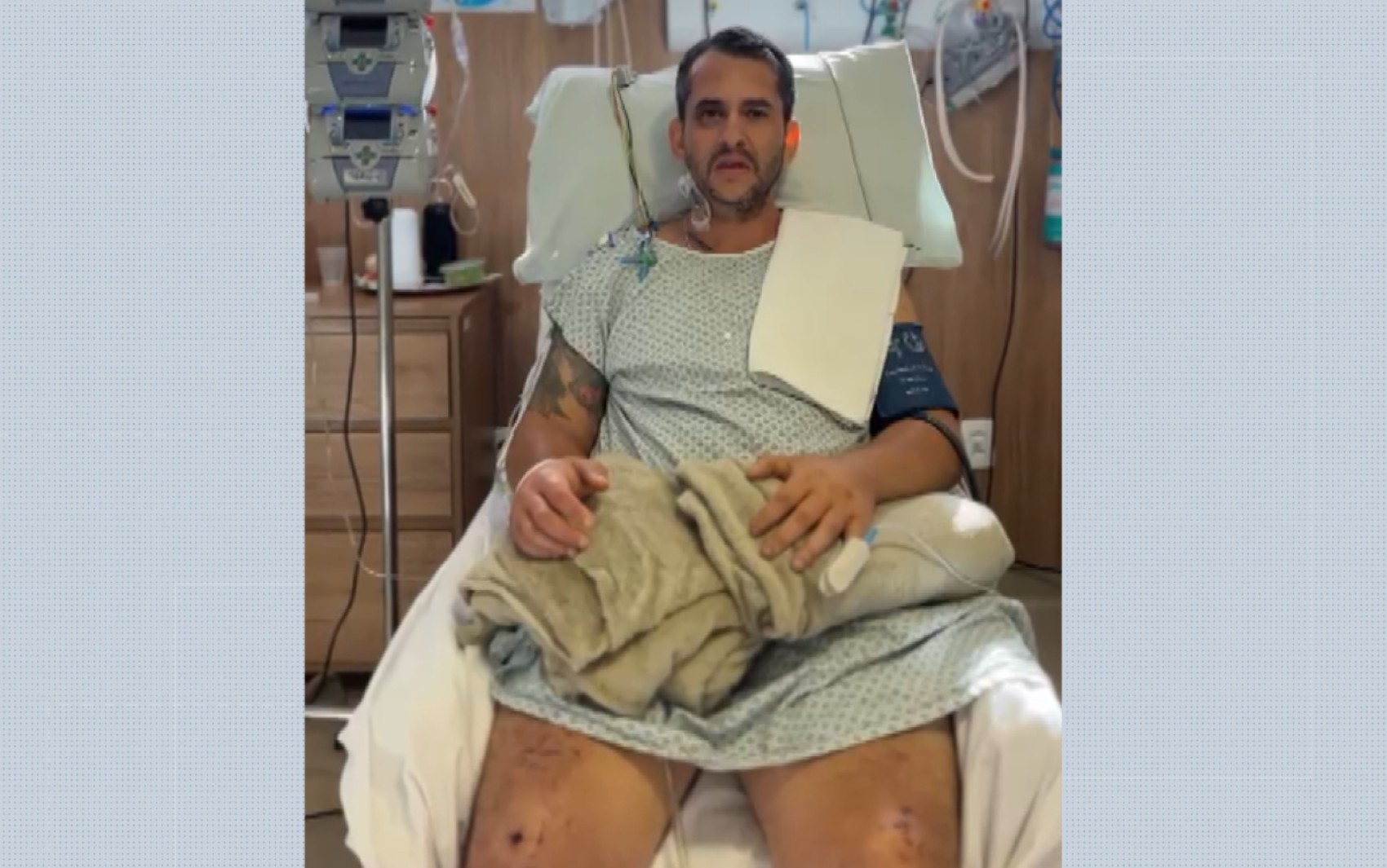 Motociclista ferido passa 2 dias em mata após acidente e é salvo por ciclista em Ituverava, SP