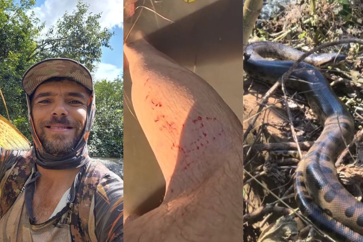 'Rei das sucuris': dente de cobra ficou preso na pele de influenciador de MS após mordida rara; VÍDEO