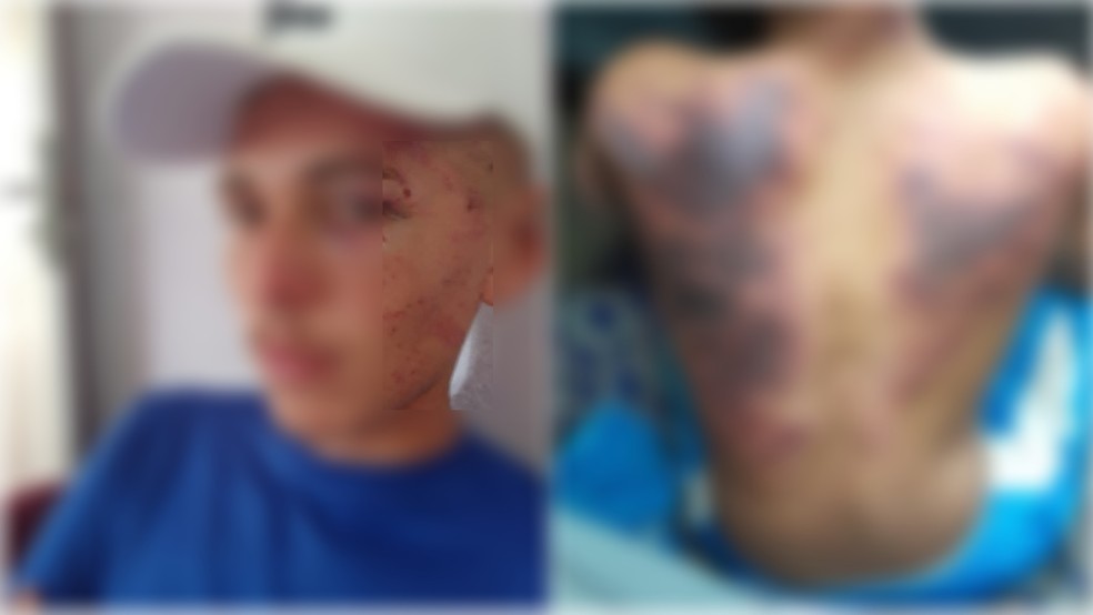 Jovens são agredidos por facção enquanto iam jogar futsal, no Ceará. — Foto: Arquivo pessoal