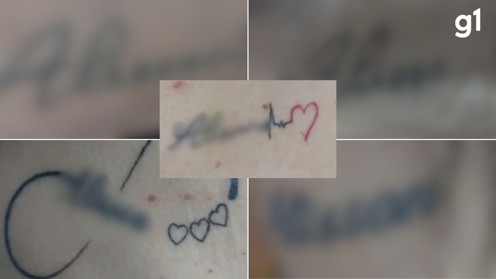 Dentista é preso suspeito de manter companheira em cárcere privado e forçá-la a fazer 10 tatuagens com o seu nome
