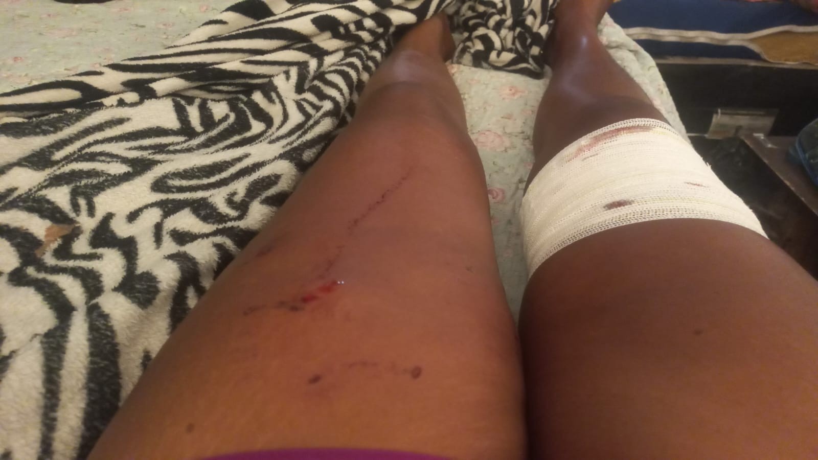 Mother and son are attacked by the family's pitbull and saved by neighbors in Divinópolis: 'We were born again'