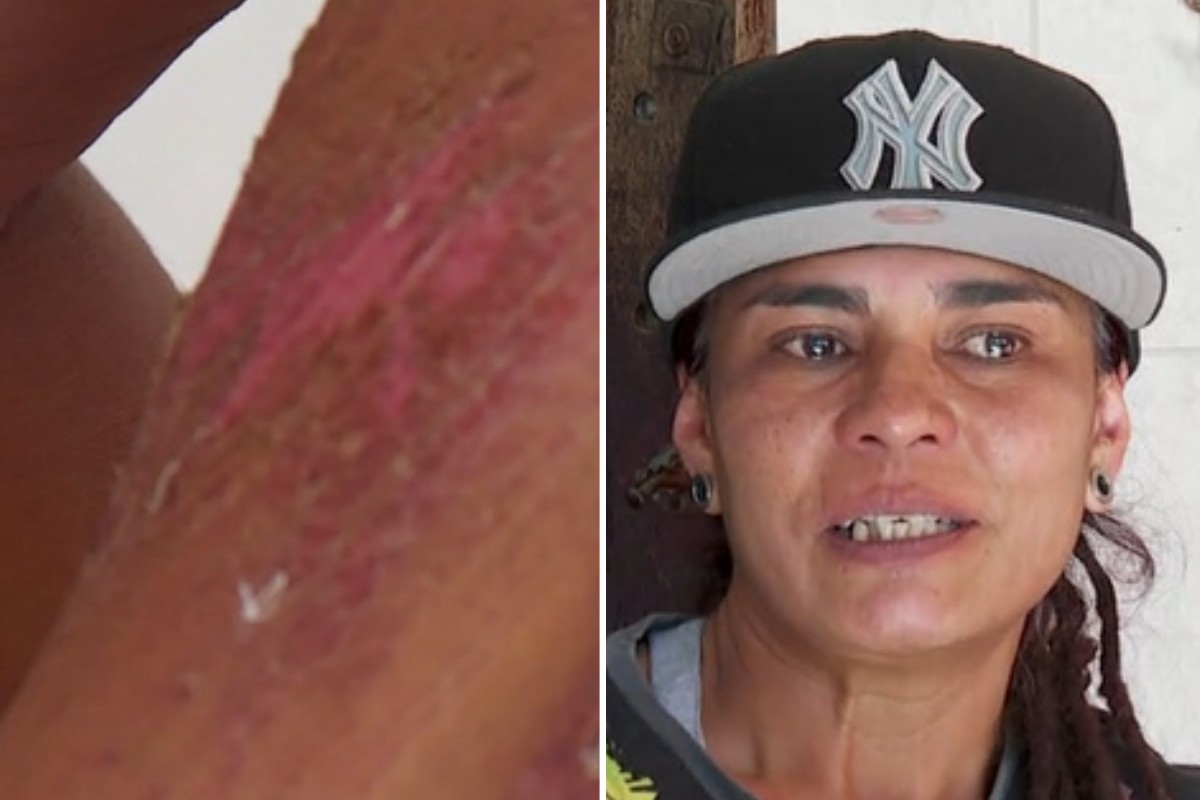 Motociclista é perseguida e atropelada após briga no trânsito no litoral de SP