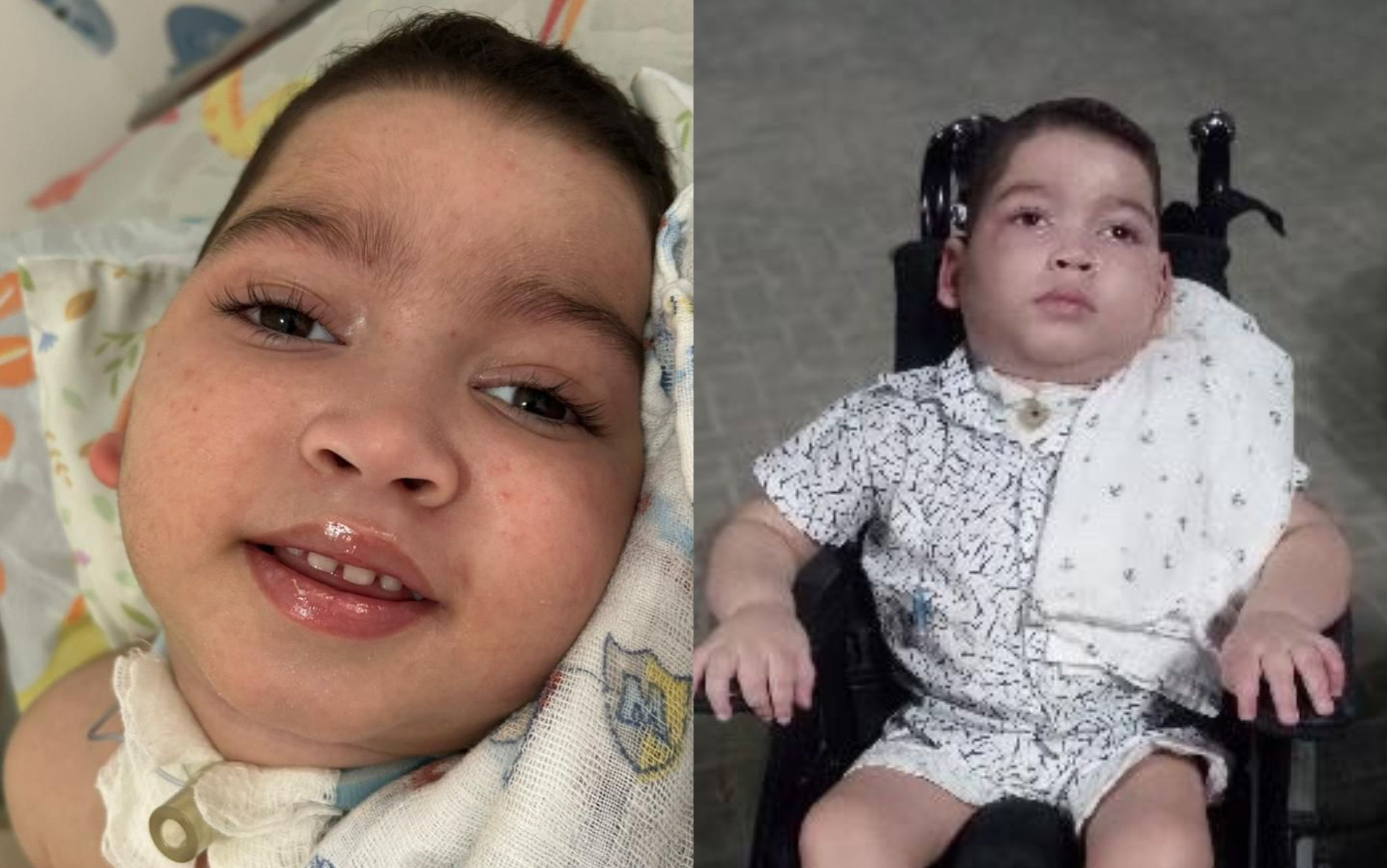 Menino de 3 anos é declarado morto por hospital e fica horas vivo sem assistência, diz família