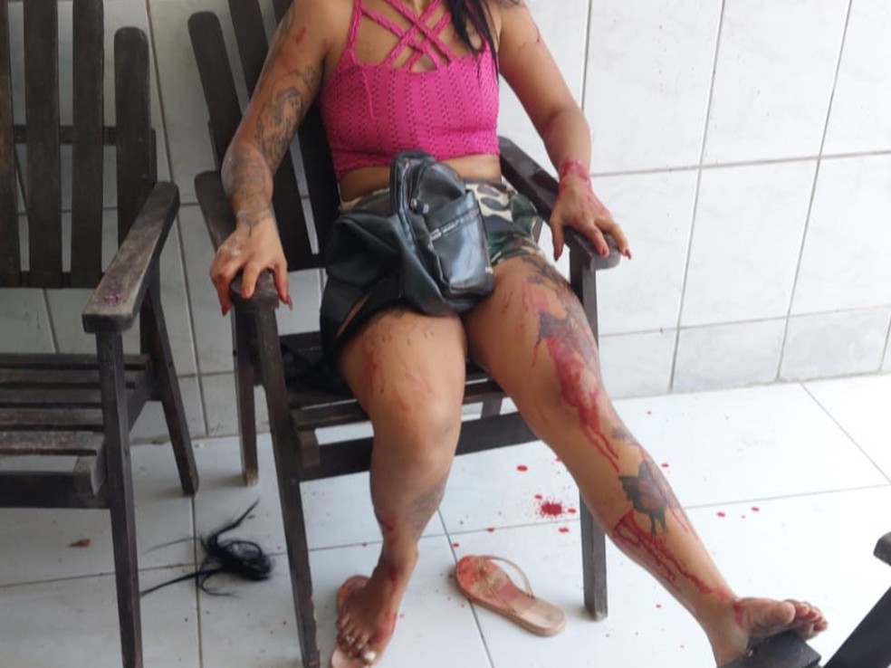Mulher feriu o próprio corpo para simular sequestro no Recife — Foto: Reprodução/WhatsApp