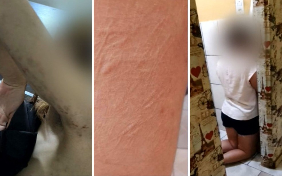 Adolescente mantida em cárcere privado em Goiás sofria tortura e tinha marcas das agressões pelo corpo — Foto: Reprodução/TV Anhanguera