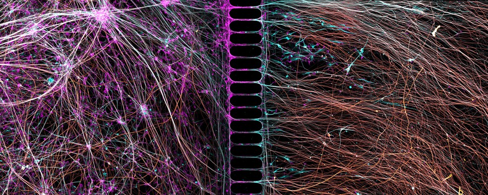 7º lugar: Neurônios humanos produzidos a partir de células da pele crescem em uma pequena câmara de laboratório. — Foto: Bruno Cisterna e Eric Vitriol/Nikon Small World