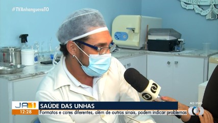 Veja como saber como está a saúde das suas unhas