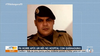 PM morre após um mês internado com queimaduras