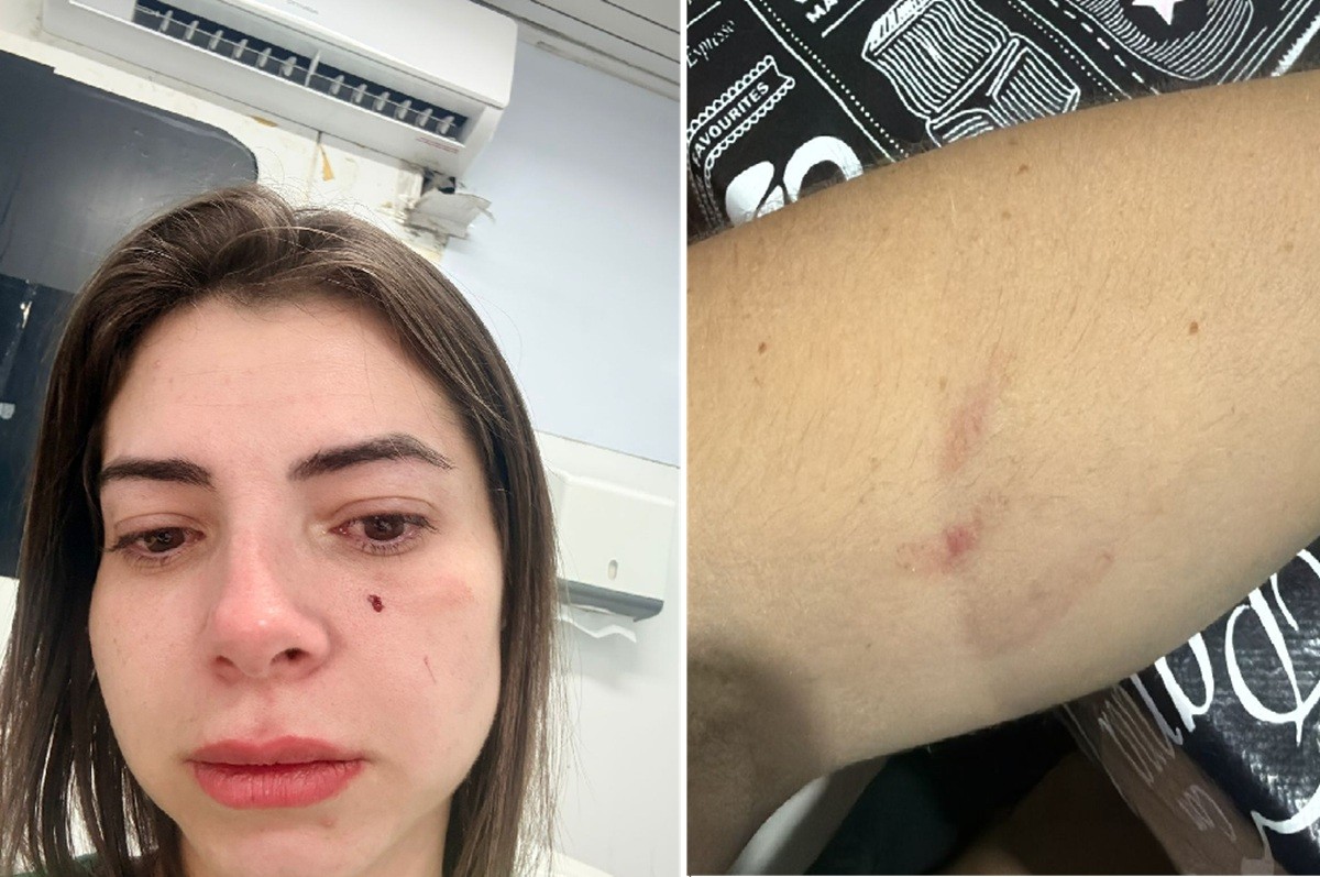Pediatra é agredida com mordidas, socos e empurrões por mãe de paciente em UPA da Barra, em Macaé