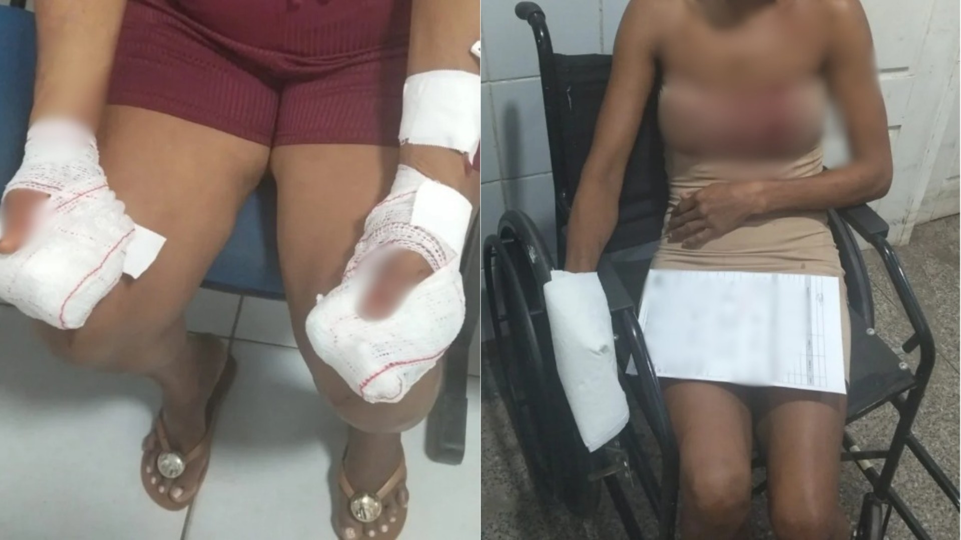 Homem é preso suspeito de agredir a mãe e a própria namorada em Codó; uma das vítimas perdeu alguns dedos 