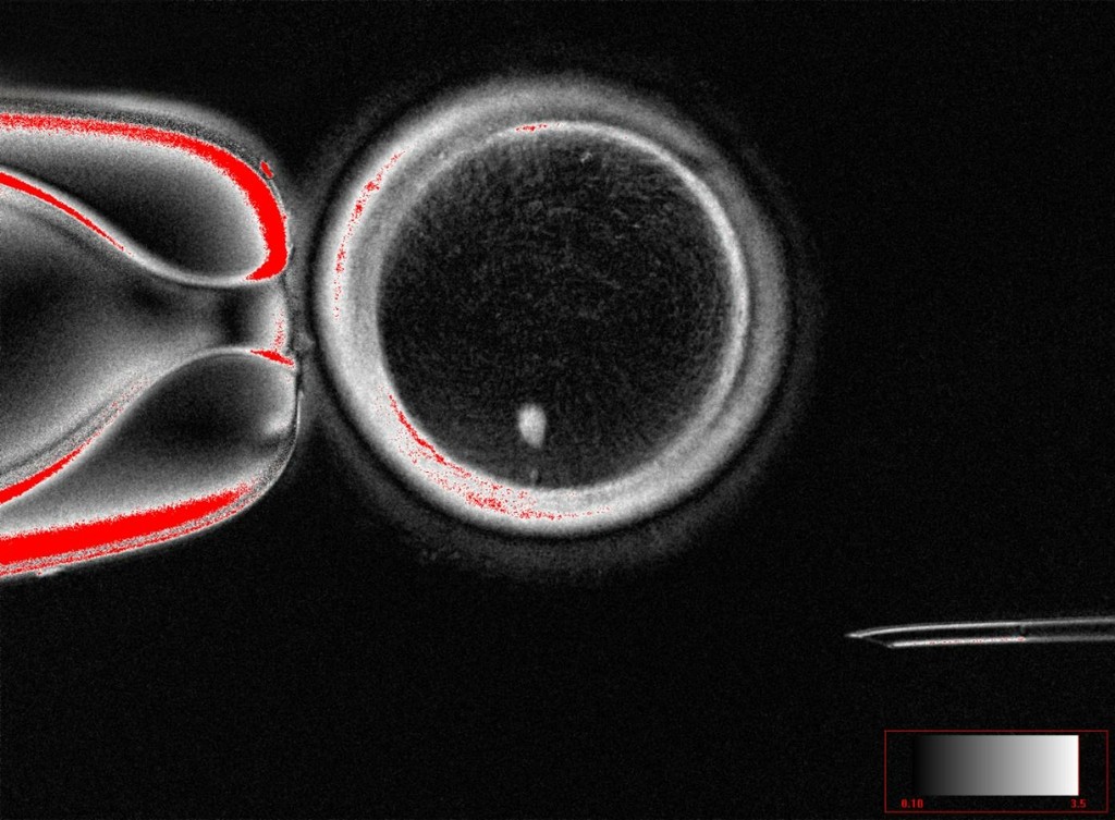 Pela primeira vez, cientistas transformam células da pele em óvulos fecundáveis