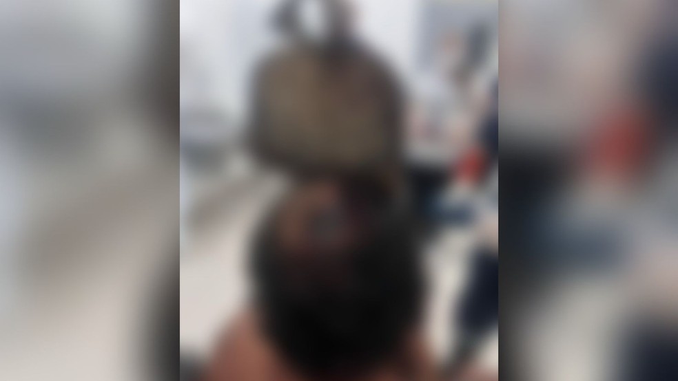 Homem fica com enxada cravada na cabeça durante briga no interior do Ceará — Foto: Reprodução