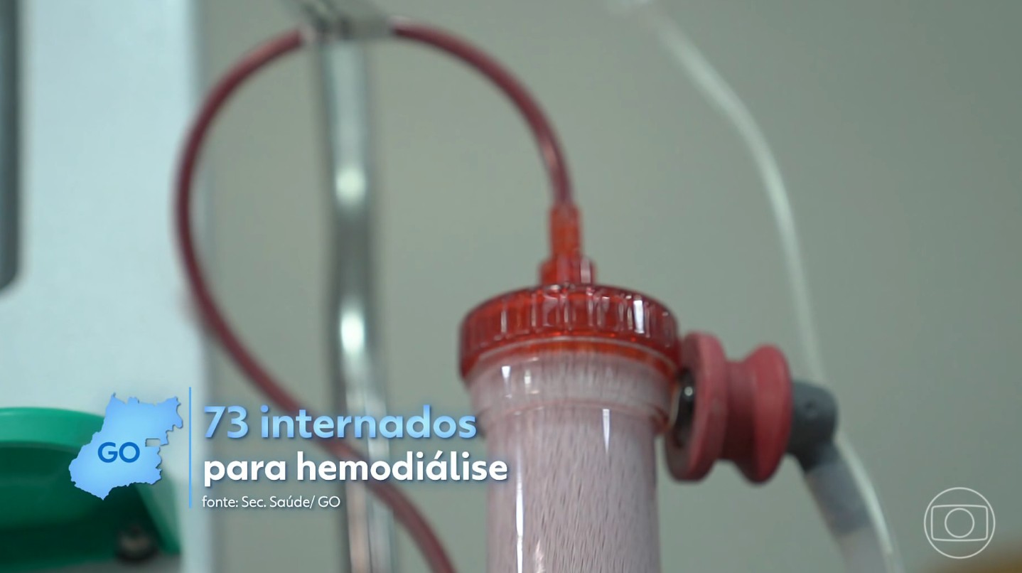 Dificuldade de obter tratamento para hemodiálise provoca internações desnecessárias de pacientes em hospitais públicos